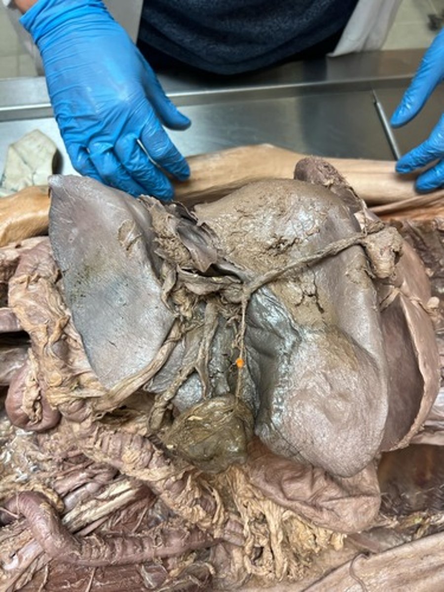 <p>cystic duct</p>