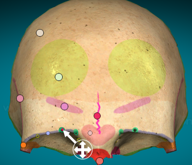 <p>supraorbital notch</p>