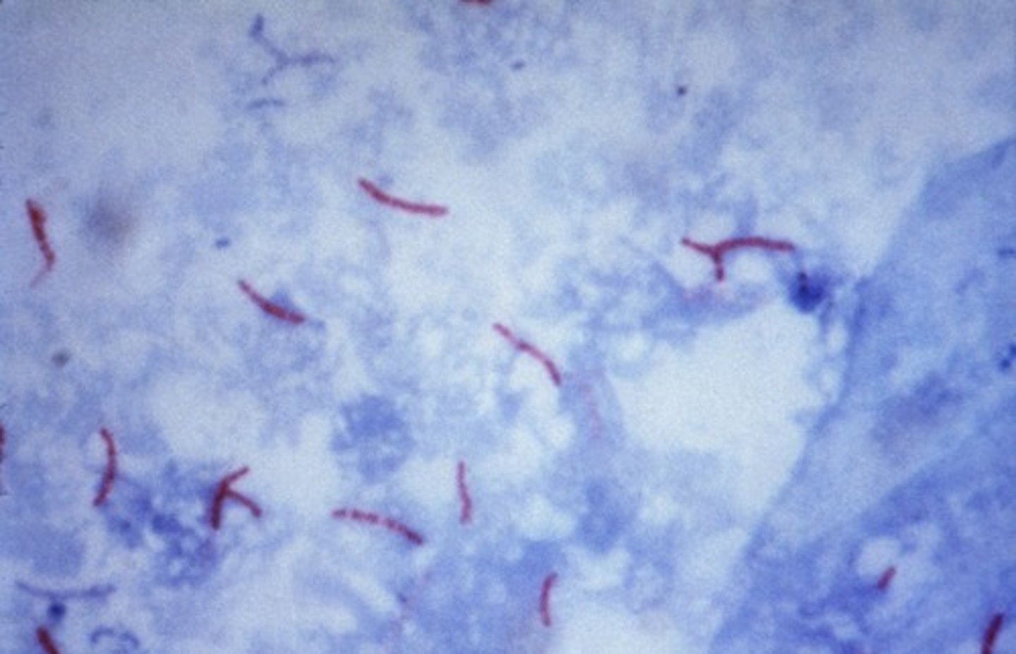 <p>Mycobacterium tuberculosis</p>