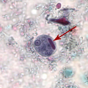 <p>a rod-like internal structure outside of the nucleus of an amoeba in its cyst phase usually comprised of ribonucleoproteins in crystalline form</p>