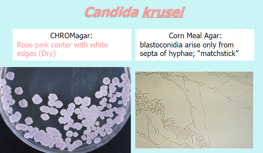 <p>chrom: rose pink center w white edges, dry</p><p>CMA: blastoconidia arise only from septa of hyphae, matchstick (septate or pseudoseptate)</p><p></p><p>**intrinsically fluconazole-R</p>
