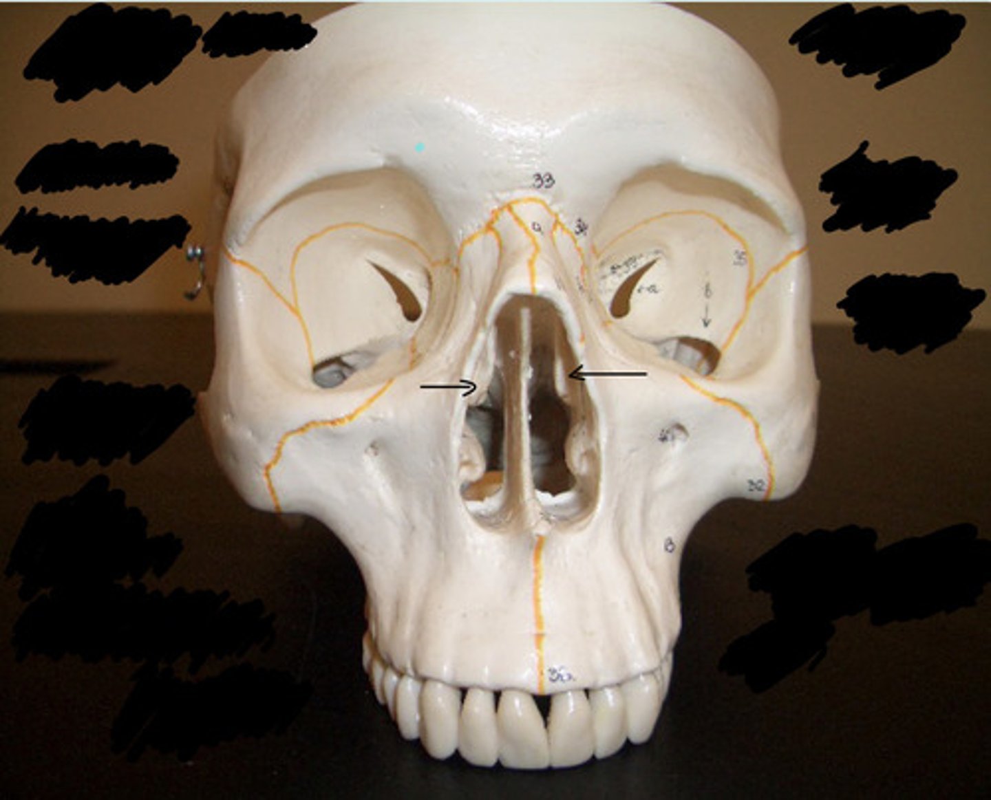<p>What structure is pointed to here?</p>