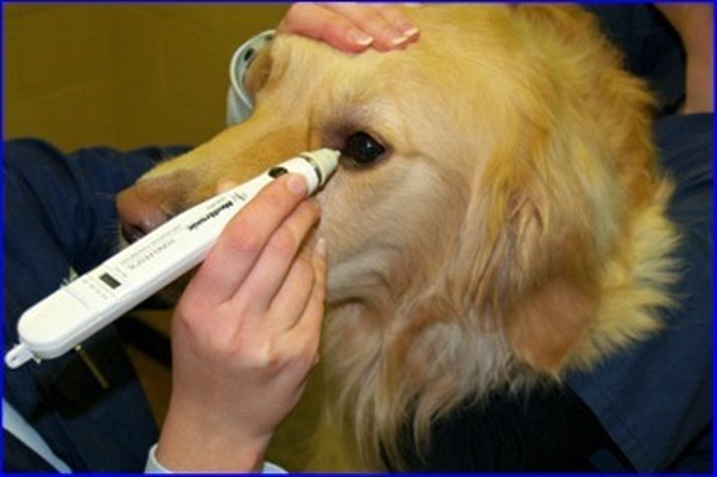 <p>Measures intraocular pressure by gently touching the pen to the patient's central cornea</p><p>-used to diagnose glaucoma</p>