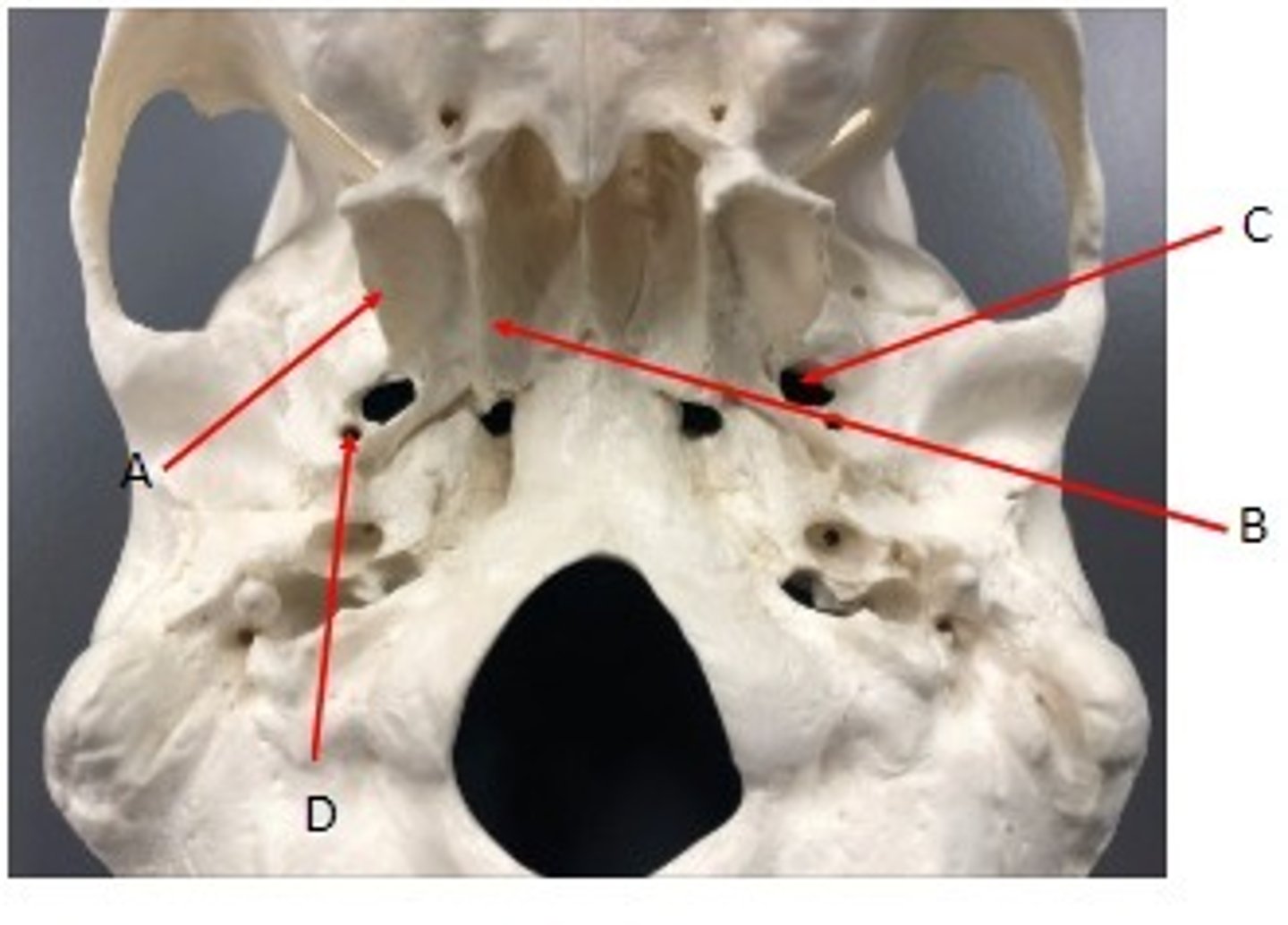 <p>What category of bone is it? What bone is it? Label the structures.</p>