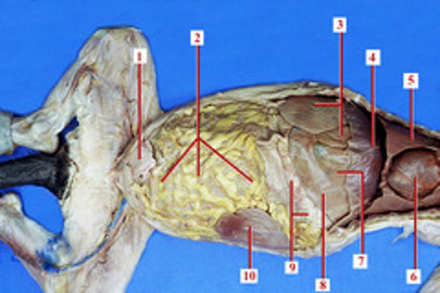 <p>Fatty tissue covering abdominal organs.</p>