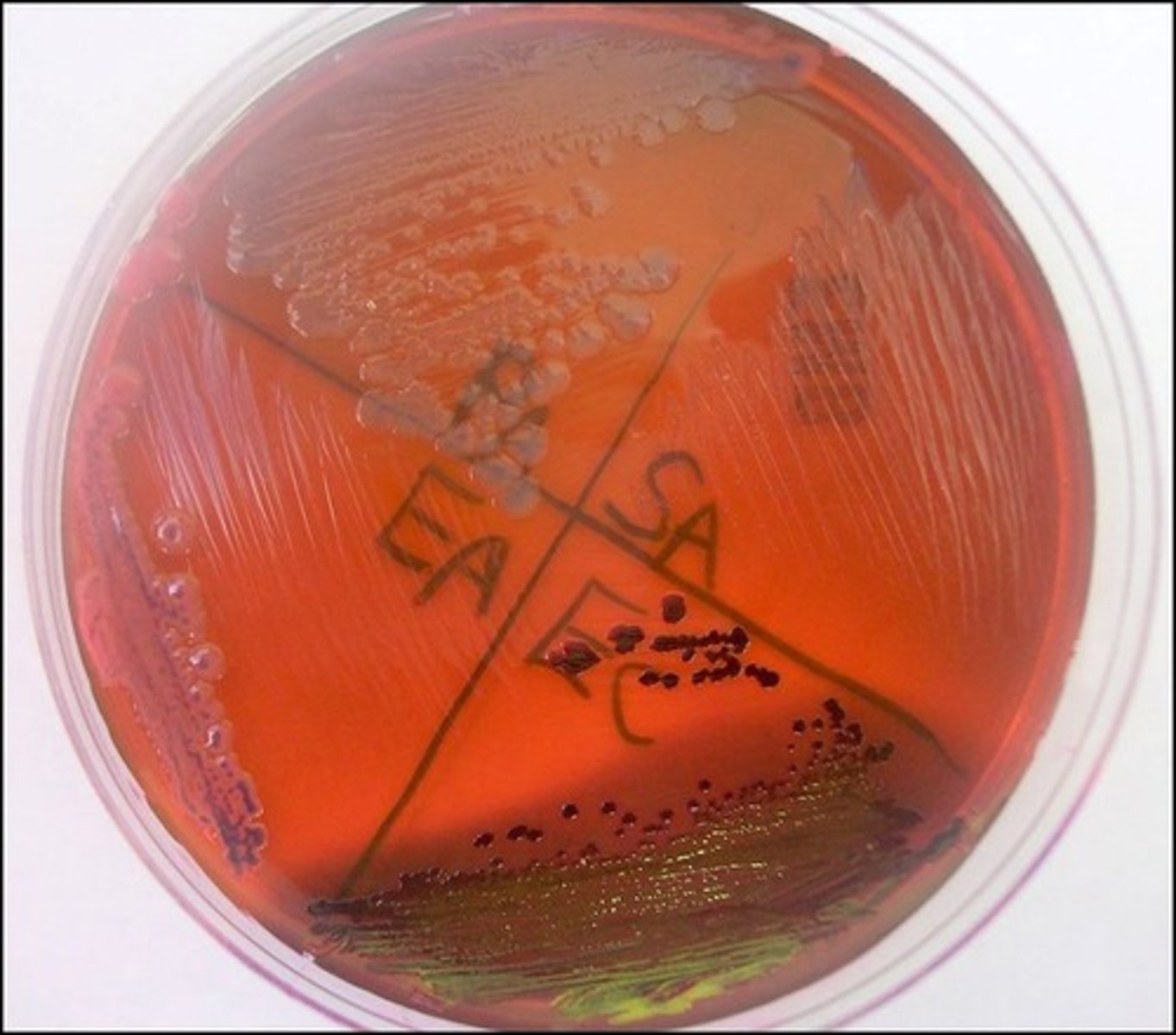 <p>On EMB, E. coli produces a</p>