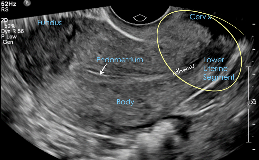 <p>transvaginal pelvic anatomy in LONG</p>