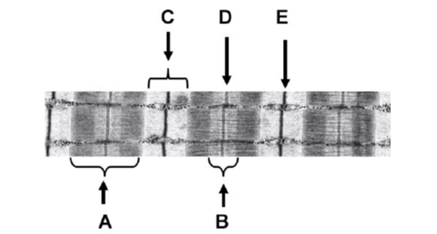 <p>What is B on the diagram?</p>