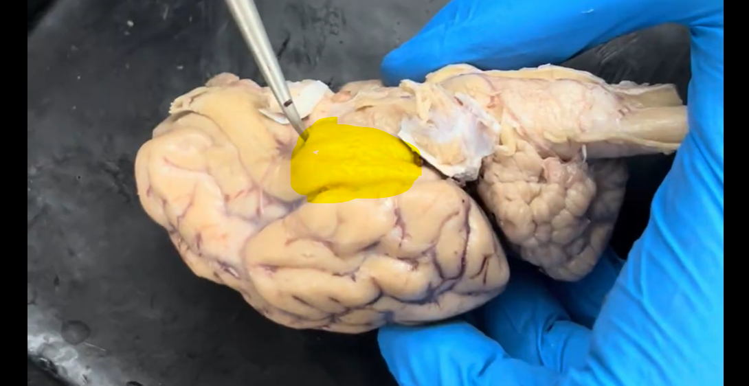 <p>Name the part of the brain at the tip of the probe and highlighted in yellow.</p>
