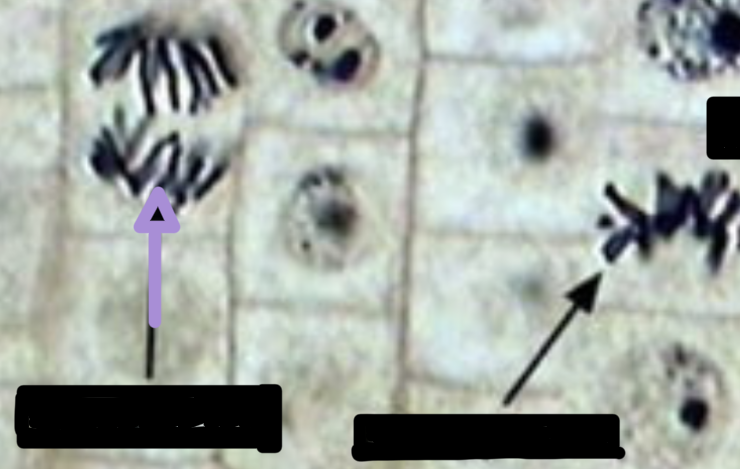 <p>what stage of cell division is this? </p>