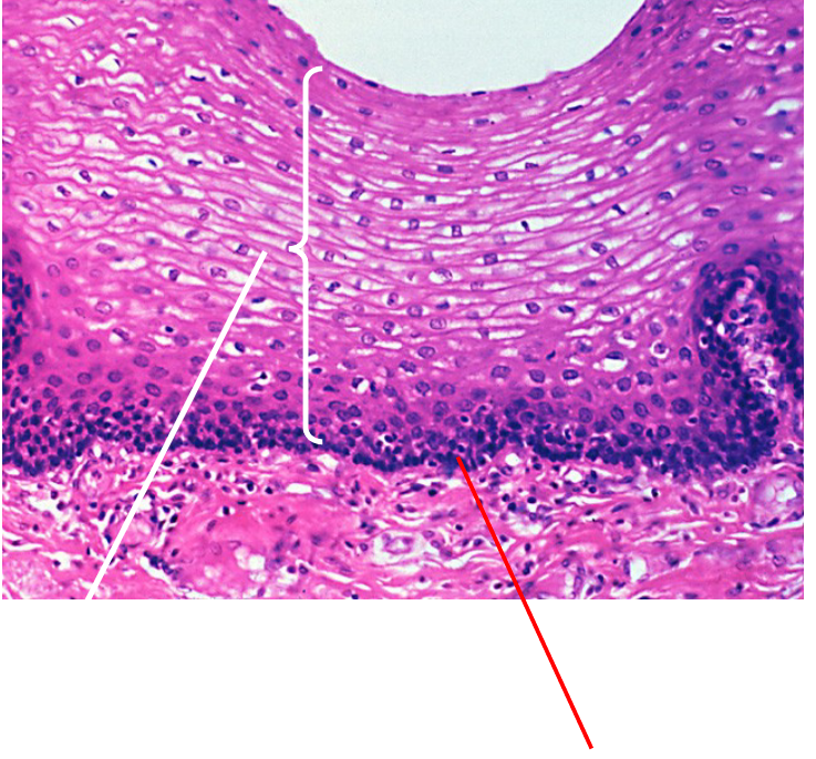 <p>What part of the stratified epithelium is this?</p>