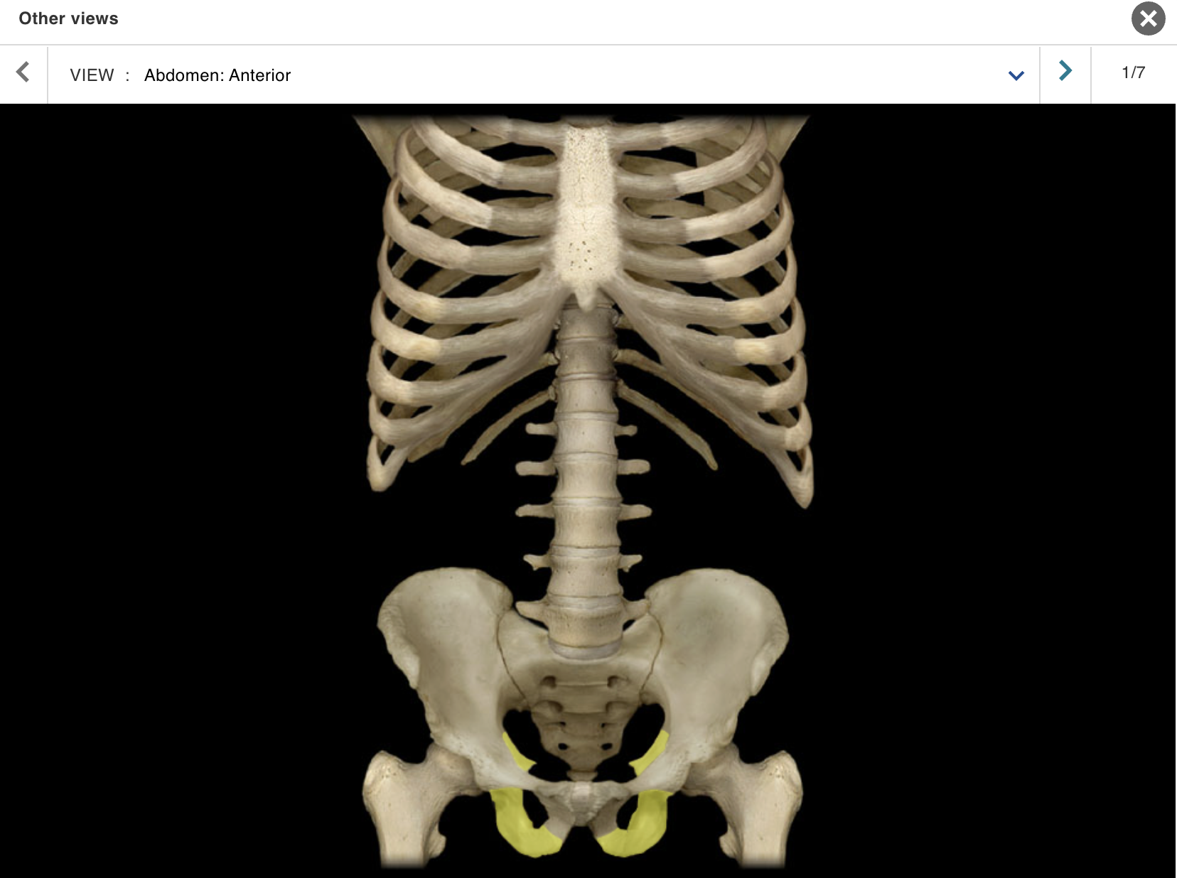 <p>Location:</p><p class="p1">• Pelvis</p><p class="p1">Description:</p><ul><li><p>﻿﻿One of three coxal (hip) bones</p></li><li><p>﻿﻿Characteristic features include tuberosity and spine</p></li><li><p>﻿﻿Contributes to acetabulum (hip joint socket), obturator foramen, and wall of lesser (true) pelvis</p></li></ul><p>Comment:</p><ul><li><p>﻿﻿Fused with ilium and pubis in adult to form coxal (hip) bone</p></li><li><p>﻿﻿Bony pelvis formed by paired hip bones and sacrum</p></li><li><p>﻿﻿Obturator foramen formed by rami of pubis and ischium</p></li></ul><p></p>
