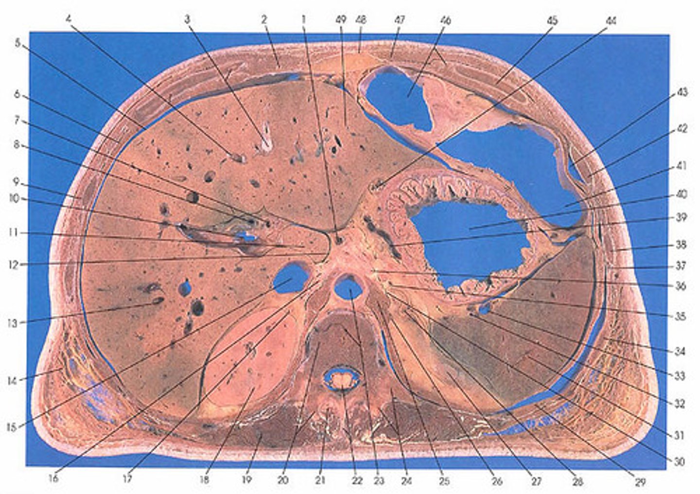 <p>Crossection</p>