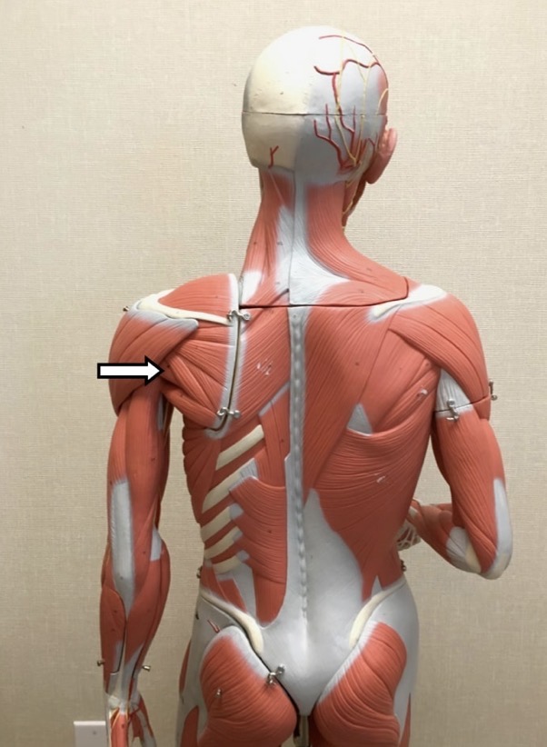 <p><span>Name the muscle labeled with the white arrow below AND name ONE action</span></p>