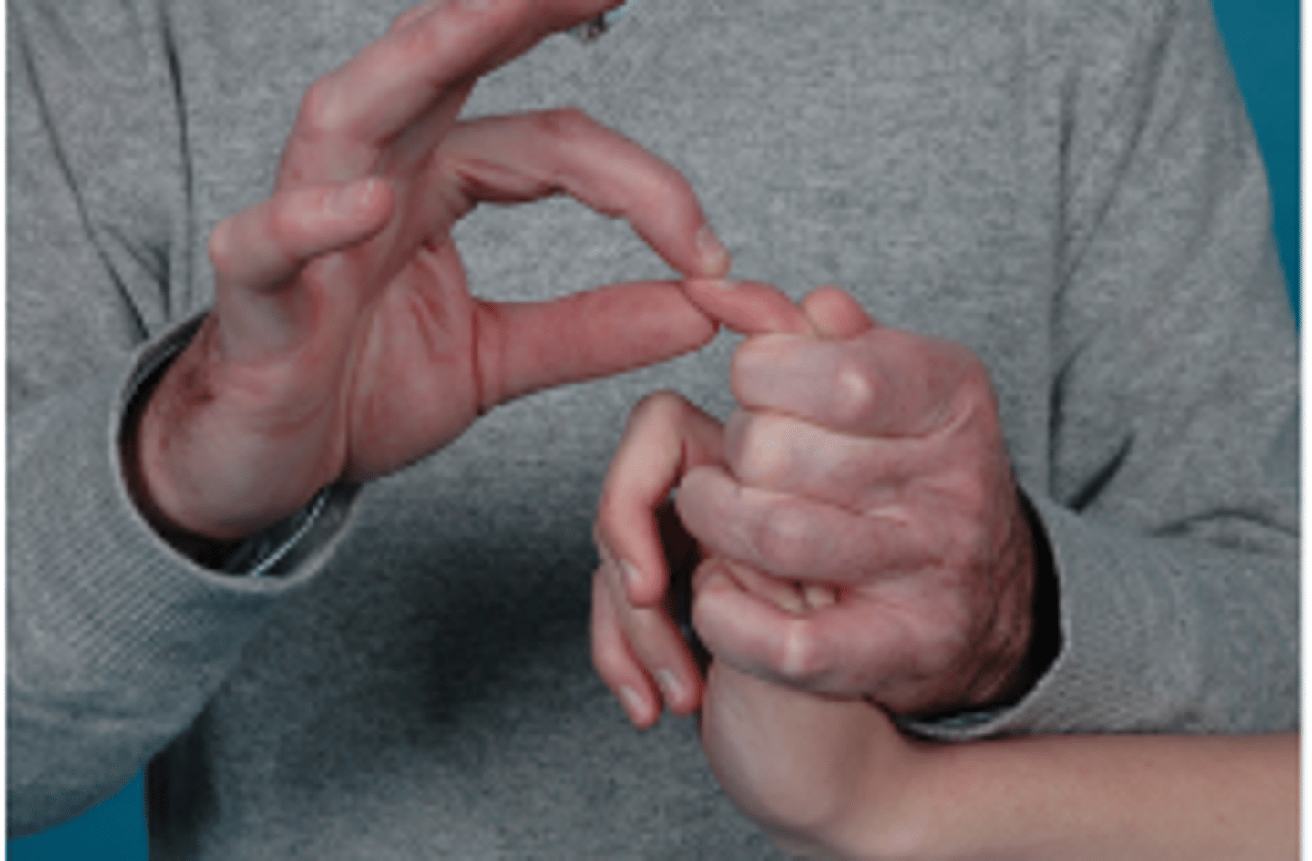 <p>Assesses if restricted flexion at DIP is d/t DIP restriction or tightness of the oblique retinacular ligament</p>