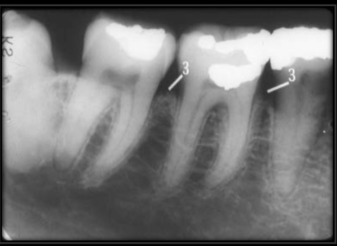 <p>This is the line of bone that houses the teeth</p>