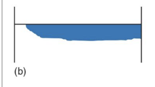 <p>This picture represents:</p>