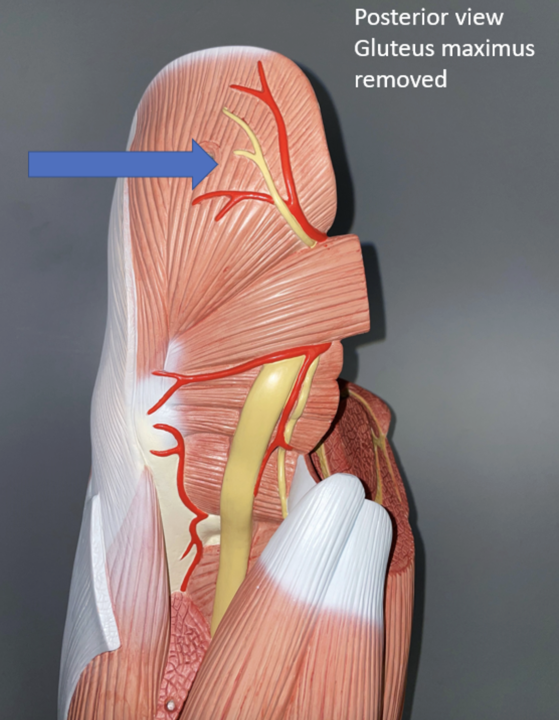 <p>muscle name &amp; action</p>