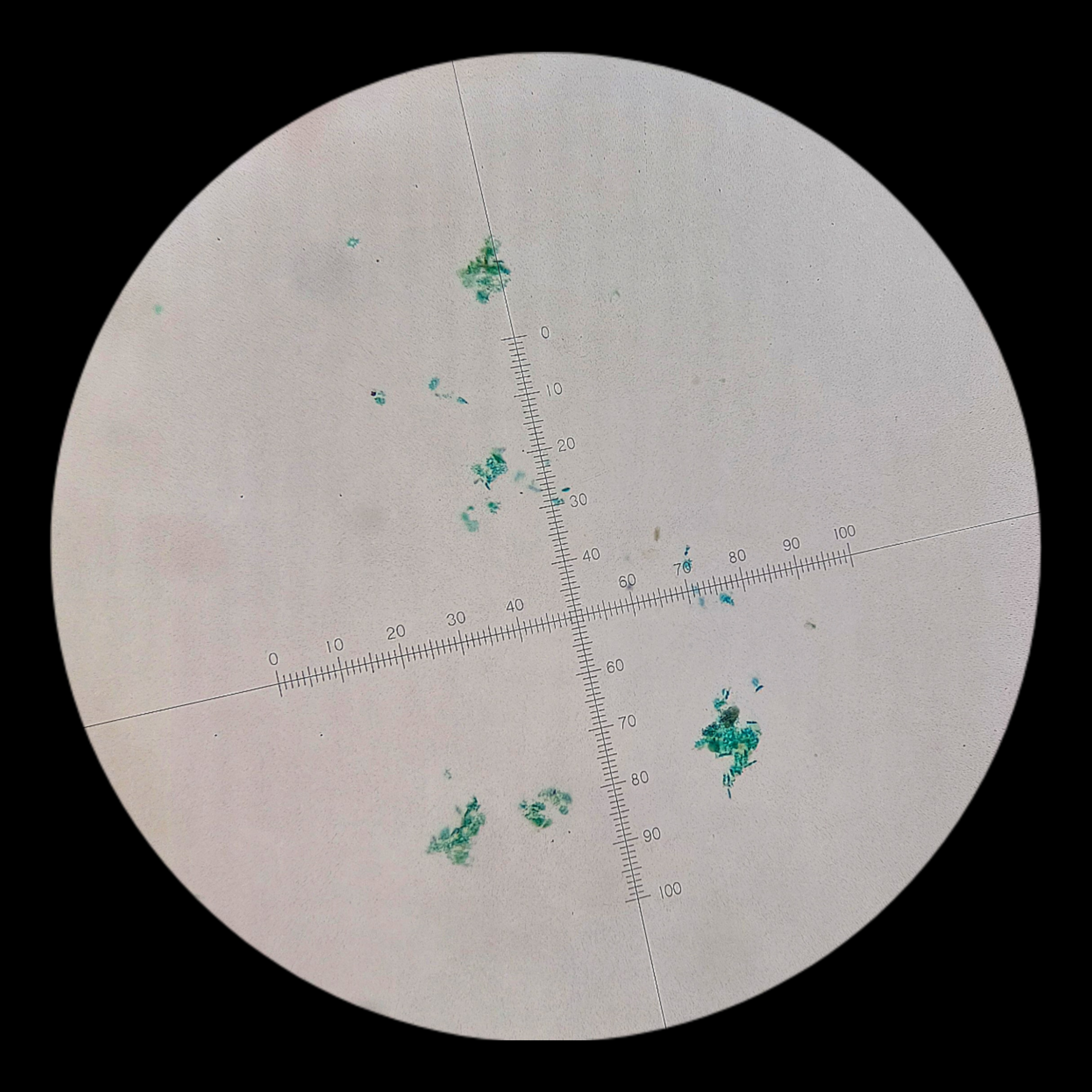 <p><strong><em>Pediastrum</em></strong></p><p><strong>Phylum: ?</strong></p>