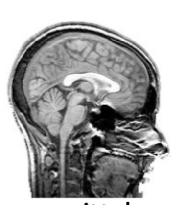 <p>what slice of the brain is this?</p>
