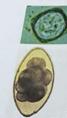 <p>eggs - sheep feces?</p>