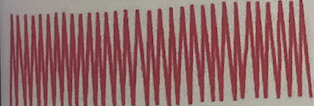 <ul><li><p><strong>Rapid, deep, labored</strong></p></li><li><p>Type of hyperventilation associated with <strong>diabetic ketoacidosis</strong></p></li></ul><p></p>