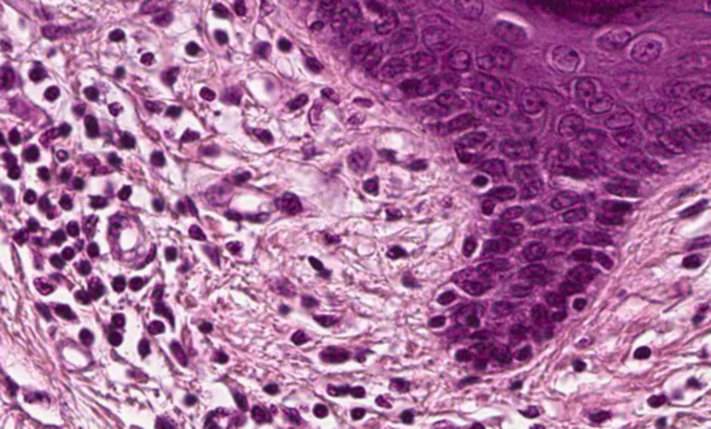 <p>Består av bindevevsceller. De varierer mye, fra store bindevevscelle til små blodceller. I brusk, bein, blodceller og fett. Binder sammen, støtter og beskytter andre typer vev. Alle bindevevscellene skiller ut væske som omgir cellene</p>