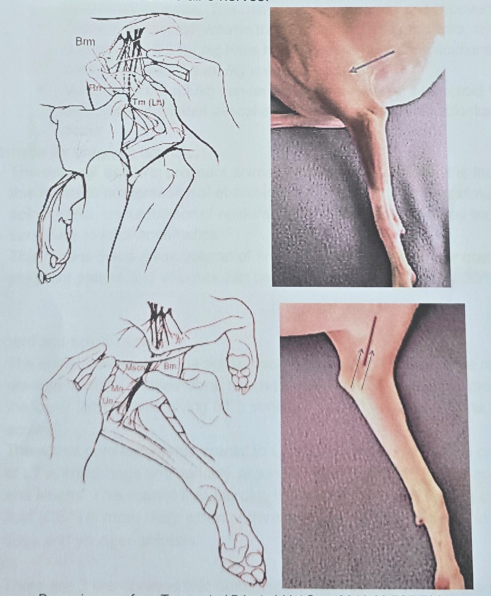 upper: radial, lower: rest