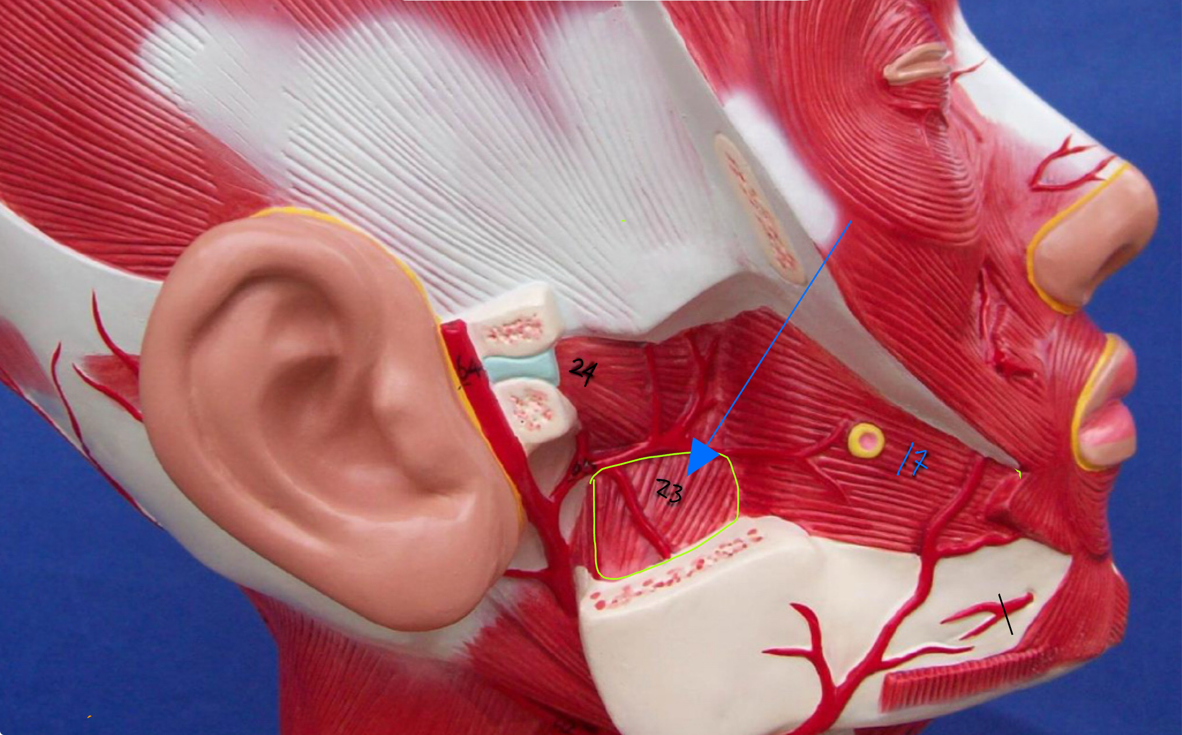 <p>What type of muscle is this ( altay model ) </p>