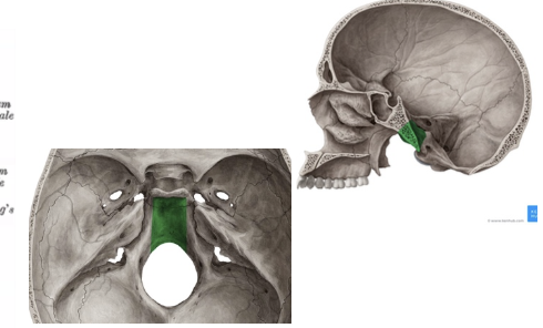 <p>Unión entre lámina cuadrilátera del esfenoides y apófisis basilar (occipital).</p>