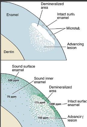 <p><span><strong>• Uptake of fluoride depends on the level and length of time exposed</strong></span></p><p><span><strong>• Hypomineralized enamel absorbs fluoride in greater quantities than healthy enamel</strong></span></p><p><span><strong>• Hydroxyapatite crystalline becomes fluorapatite</strong></span></p><p><span><strong>• Intact outer surface enamel has the greatest concentration</strong></span></p>