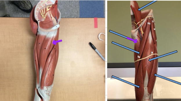 <p>Identify this muscle?</p>