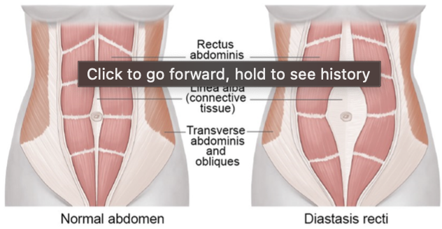 <ul><li><p>Some women have separation of rectus abdominal muscles</p></li><li><p>Changes in joints during pregnancy can cause feet to permanently increase 2 sizes</p></li></ul>