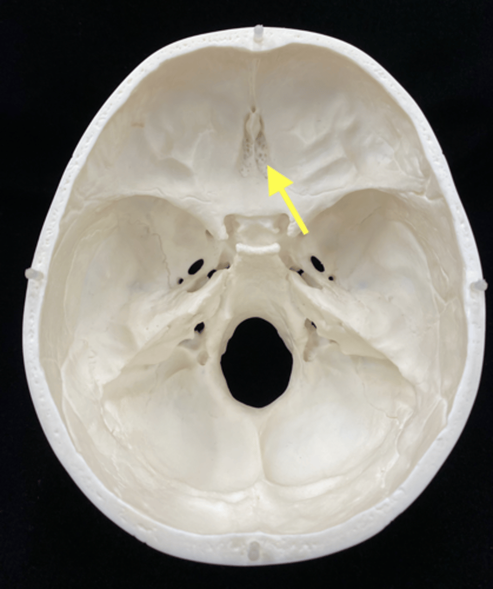 <p>name the bone and bone feature</p>
