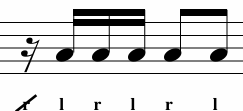 <p>What Variation is This? </p>