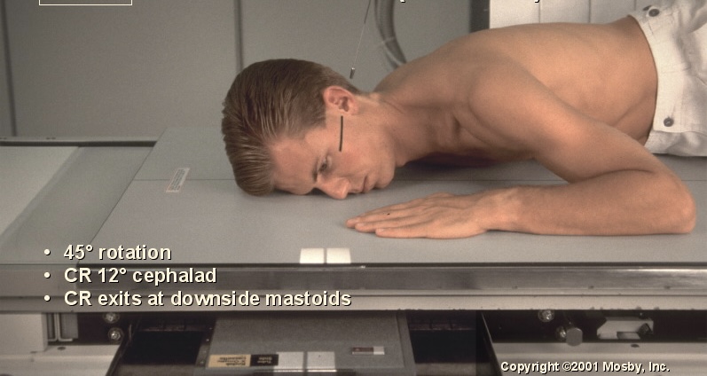<p>What position is this?</p>