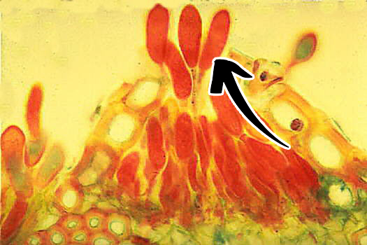 <p>Puccinia graminis: Vilken spor är detta?</p>