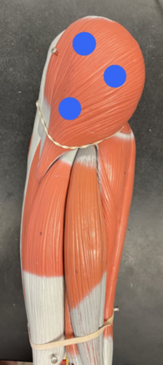 <p>Outermost piece on the big leg</p>