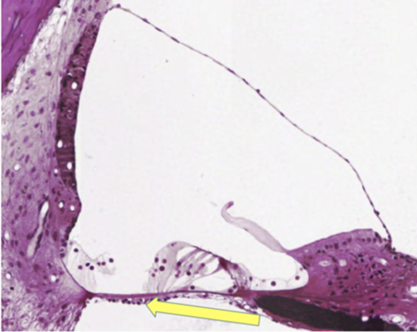 <p>Identify the structure</p>