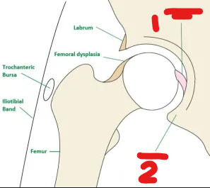 <p>what ligament is 1</p>