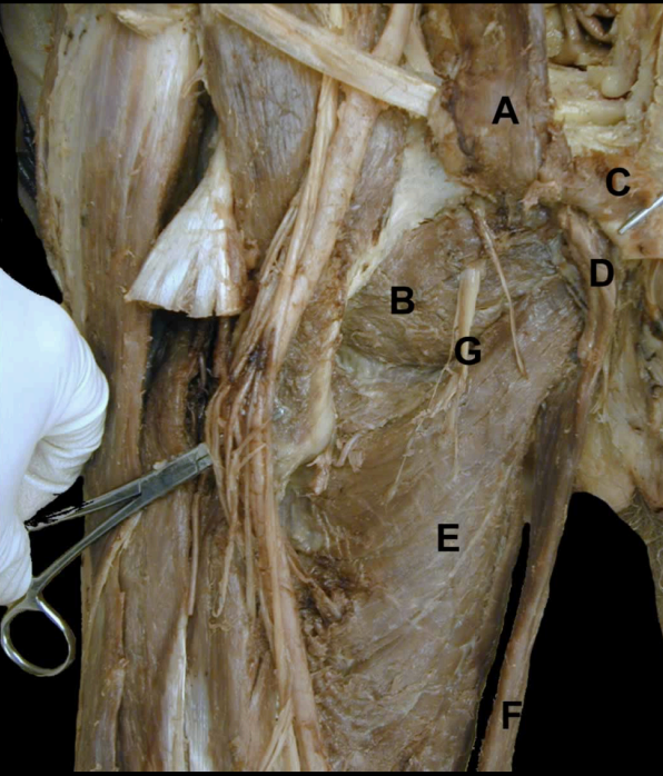 <p>Identify the structures on this <strong>Anterior View</strong> of the thigh’s <strong>Adductors</strong></p>
