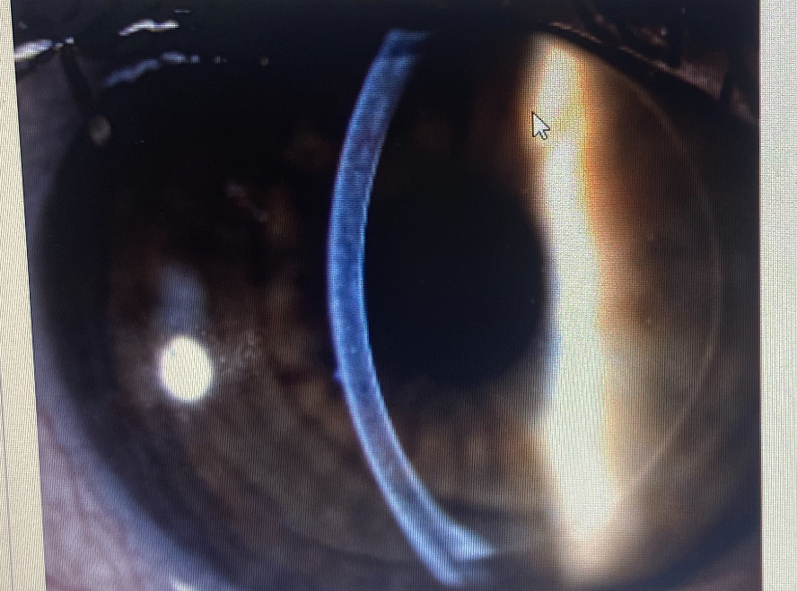 <p>What slit lamp technique is this </p>