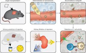 <p><strong>Acute Rejection</strong></p><p class="MsoNormal"><strong>Front:</strong> What is acute rejection?</p>