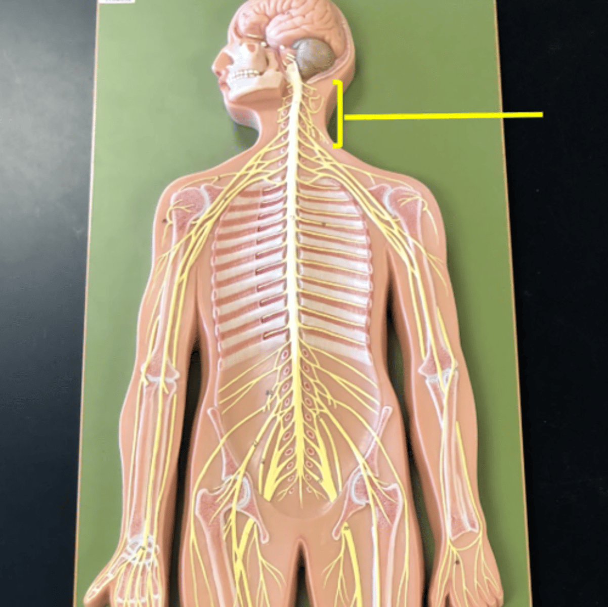 <p>_______ consists of the ventral rami of spinal nerves C1-C5. It innervates the muscles of the neck and extends into the thoracic cavity where they control the diaphragm muscles.</p>