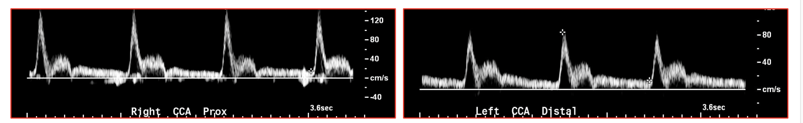 <p>How would you explain this waveform</p>
