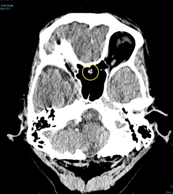 term image