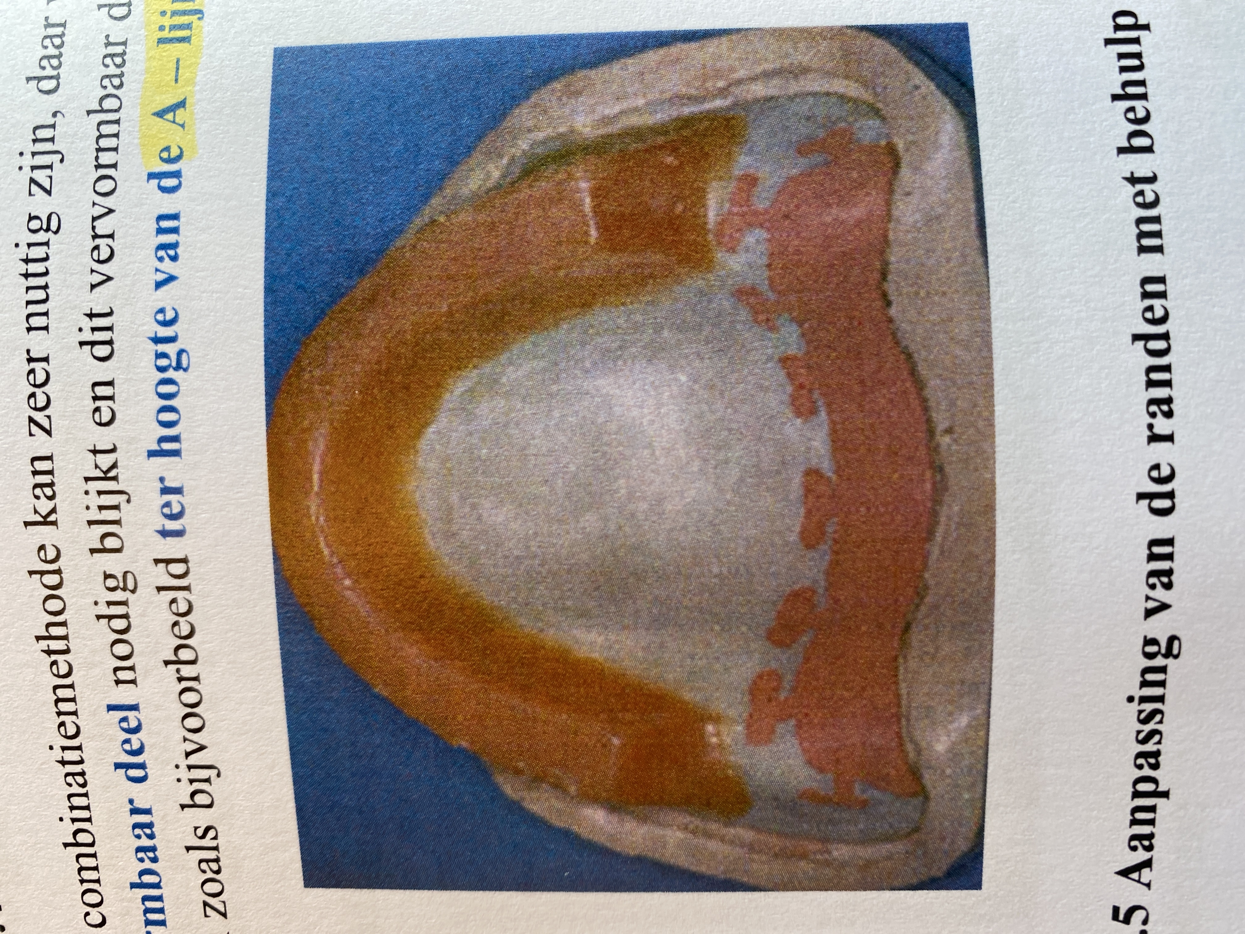 <p>Voordelen v lepels uit verschillende materialen?</p>