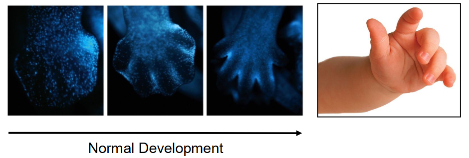 <ul><li><p class=""><strong>Programmed cell death</strong> (<strong>apoptosis</strong>) is a normal process where cells die in a <strong>coordinated sequence</strong></p></li><li><p class="">Part of <strong>organism growth</strong>/<strong>development</strong></p></li><li><p class="">Example: <strong>Interdigital cell death</strong> causes <strong>soft tissue regression</strong> between <strong>embryonic digits</strong> in many <strong>vertebrates</strong></p></li></ul><p></p>