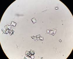 <p>Acid-neutral urine</p>