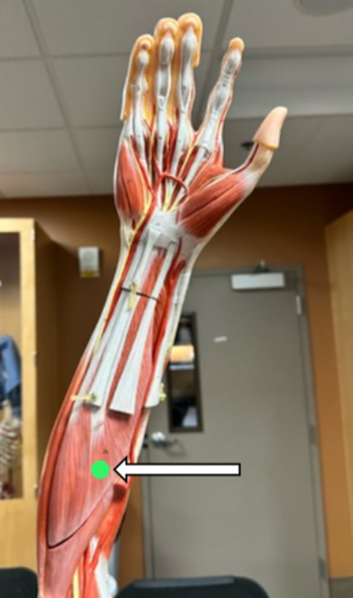 <p>flexor digitorum superficialis (function)</p>